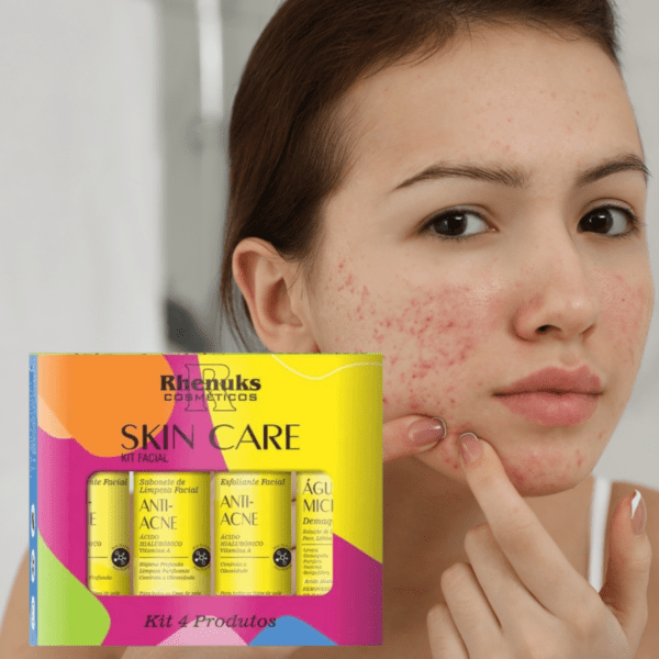 Kit Skin Care Facil anti-acne Rhenuks 4 unidades - Imagem 5