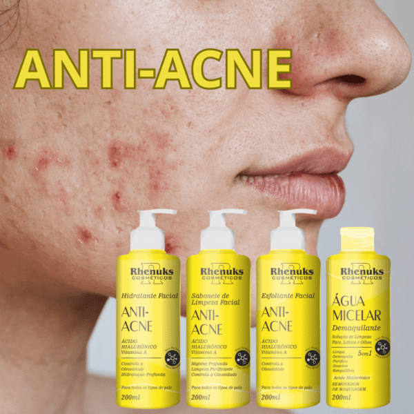 Kit Skin Care Facil anti-acne Rhenuks 4 unidades - Imagem 2