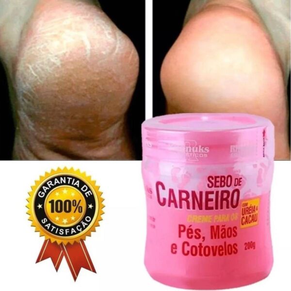 Kit 6 Creme Hidratante Pé Mãos Rachadura Sebo De Carneiro - Imagem 5